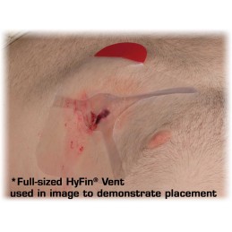 HyFin Vent Compact Chest Seal Twin Pack NAR